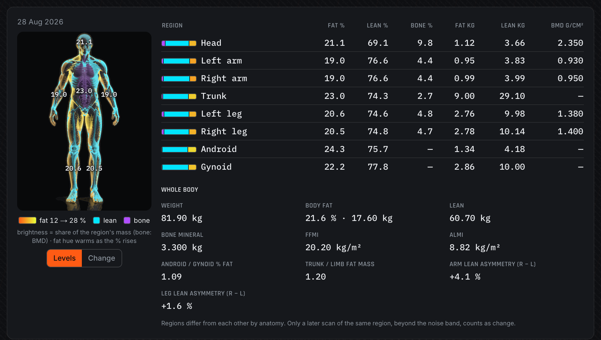 The same regional body figure and DEXA region table in the dark carbon theme (demo data)